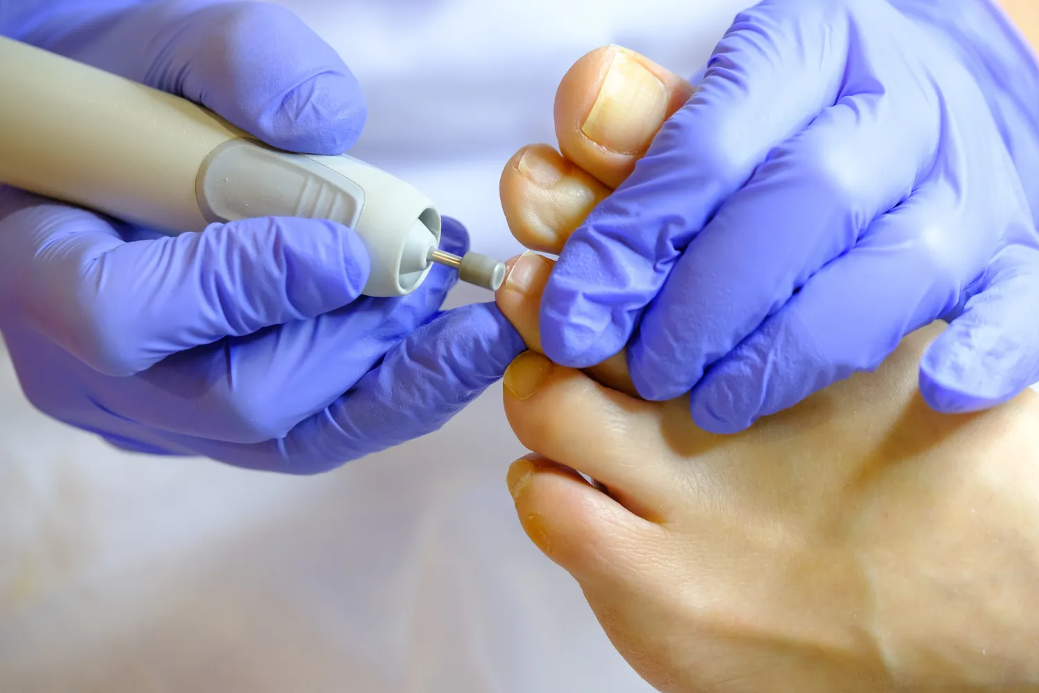 Pedicure leczniczy Szczecin