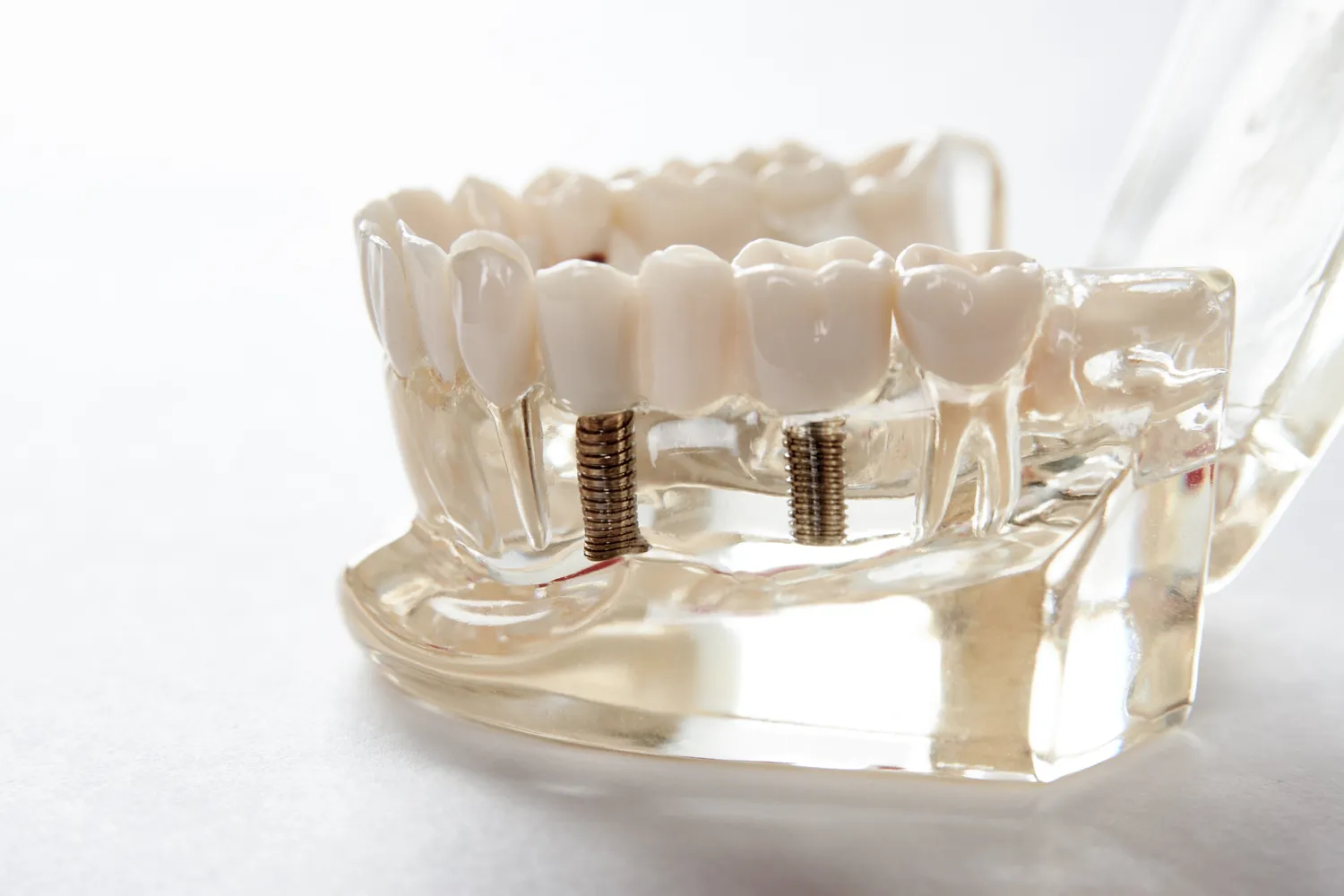 Dentysta czy stomatolog?